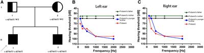 Targeted Next Generation Sequencing Revealed a Novel Homozygous Loss-of-Function Mutation in ILDR1 Gene Causes Autosomal Recessive Nonsyndromic Sensorineural Hearing Loss in a Chinese Family